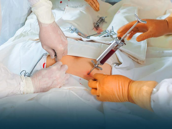 Стоимость трансплантации костного мозга в Индии